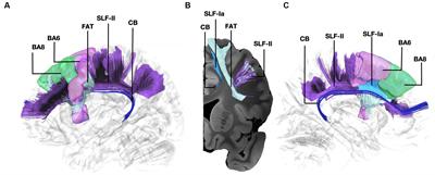 The anatomy of the four streams of the prefrontal cortex. Preliminary evidence from a population based high definition tractography study